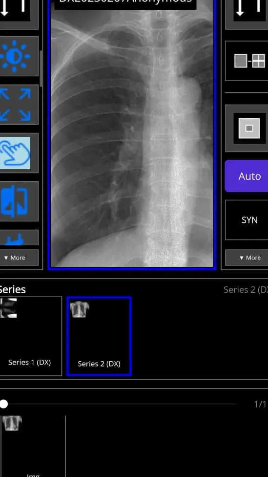 Скриншот приложения MedXDicomViewer